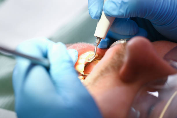 Best Emergency Broken Tooth Repair in Crenshaw, MS