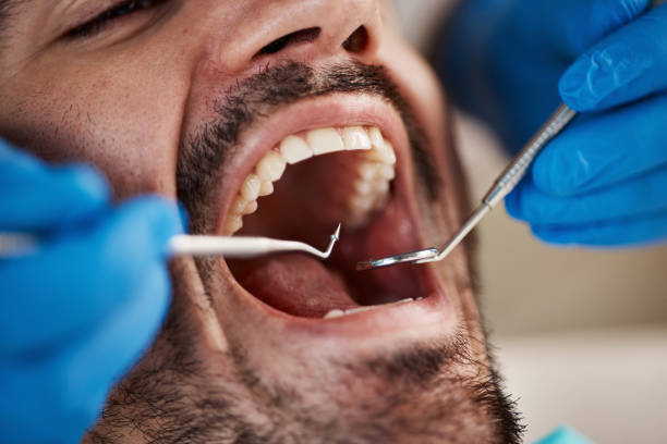 Best Emergency Wisdom Teeth Removal in Crenshaw, MS