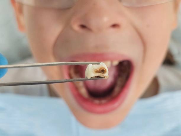 Best After-Hours Emergency Dentist in Crenshaw, MS