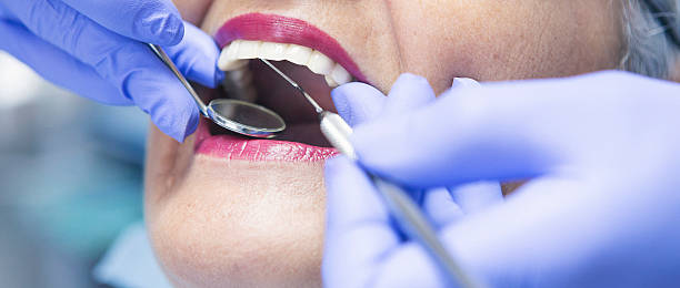 Best Emergency Wisdom Teeth Removal in Crenshaw, MS